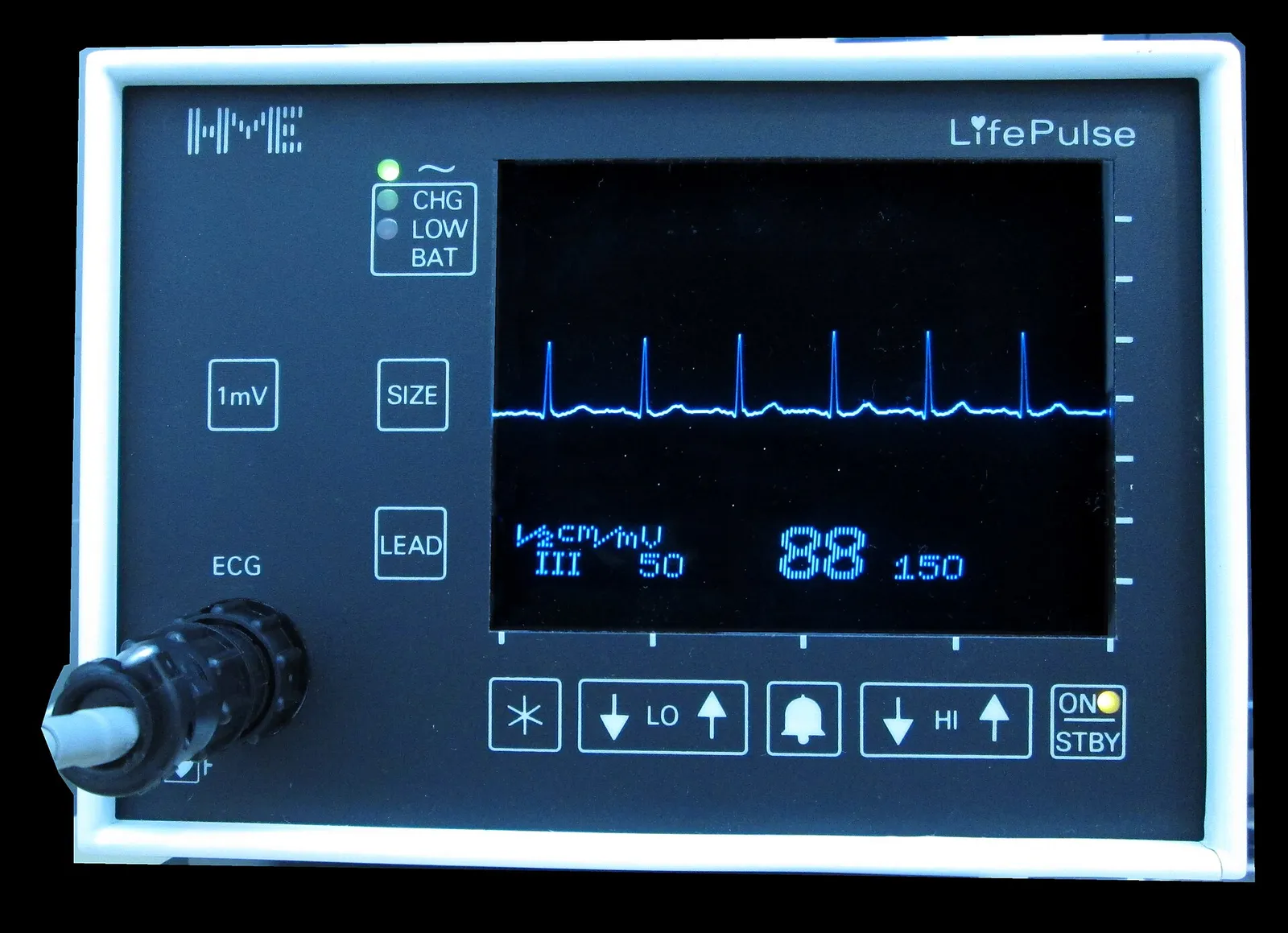 An electrocardiogram (ECG) trace