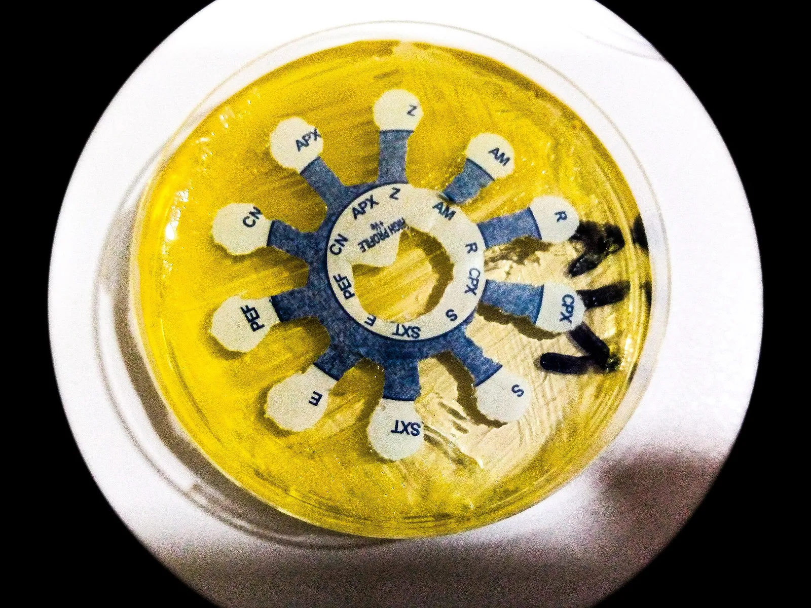 An antibiotic sensitivity test in a medical laboratory
