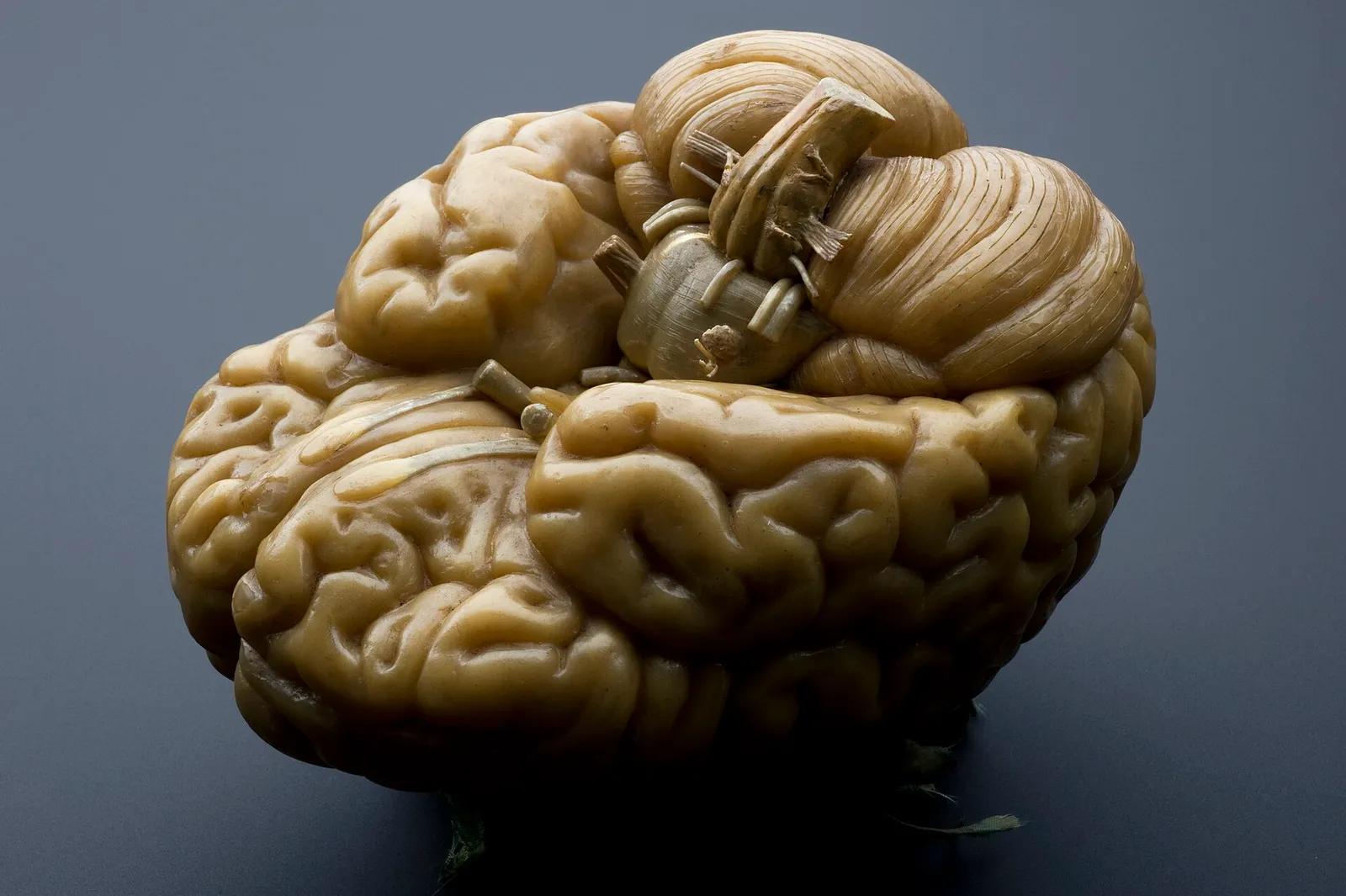 A model of a human brain (file photograph)