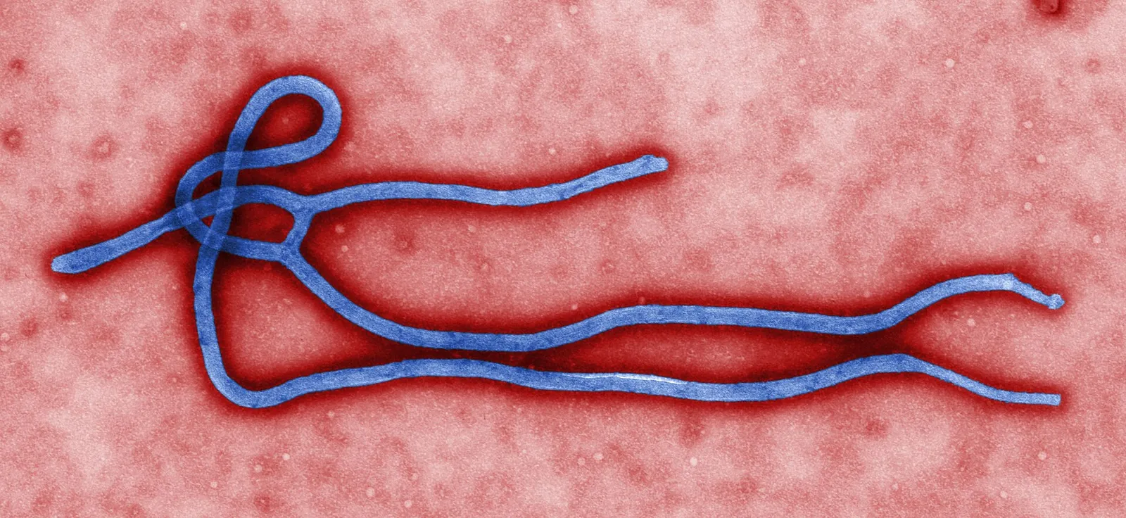 An electron micrograph of an Ebola virus virion (file image)