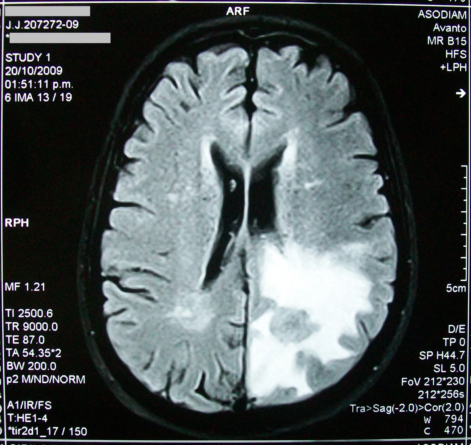 An MRI scan of a brain (file image)